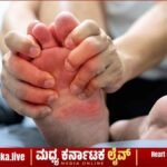 ದೇಹದಲ್ಲಿ ಯೂರಿಕ್ ಆಸಿಡ್ ಹೆಚ್ಚಾಗಿದೆಯೇ? ಕೀಲು ನೋವು ನಿಯಂತ್ರಿಸಲು ಇಲ್ಲಿದೆ ಸರಳ ಮನೆಮದ್ದು!