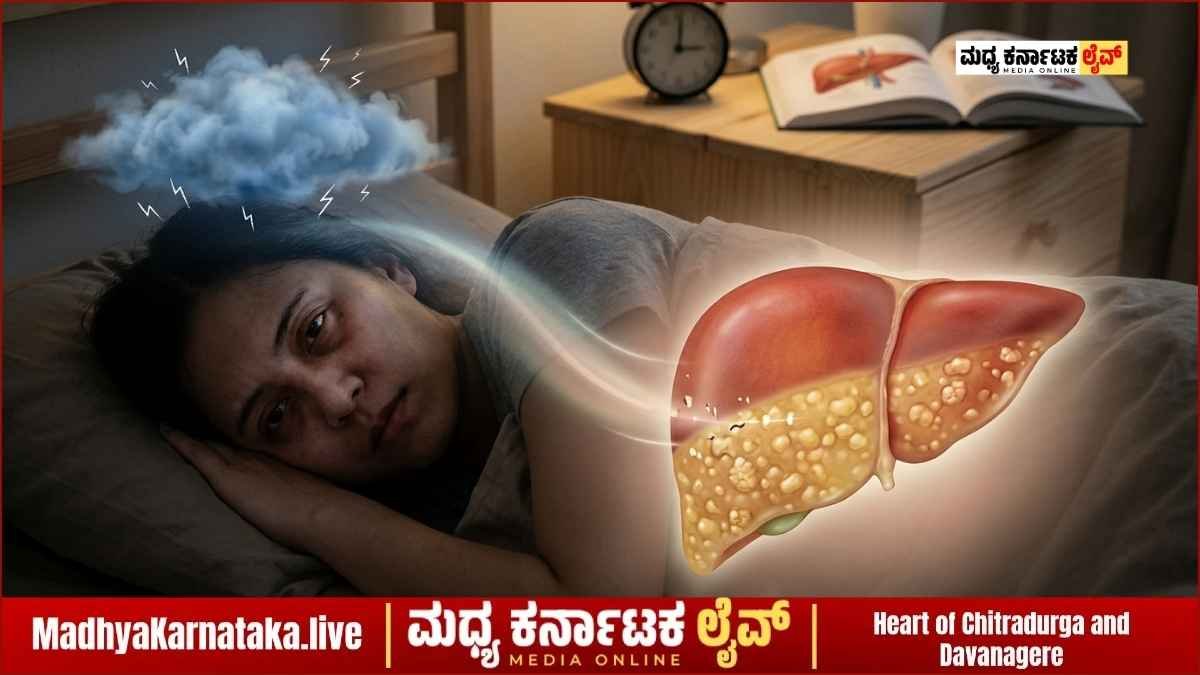 ನಿದ್ದೆ ಕೊರತೆಯಿಂದ ಫ್ಯಾಟಿ ಲಿವರ್ ಅಪಾಯ: ತಜ್ಞರು ನೀಡಿದ ಆಘಾತಕಾರಿ ಎಚ್ಚರಿಕೆ ಇಲ್ಲಿದೆ!